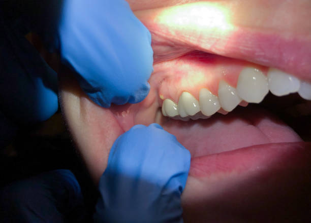 Best Knocked-Out Tooth Emergency  in Brooklyn Park, MN
