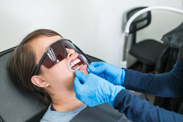 Teeth Whitening in MN